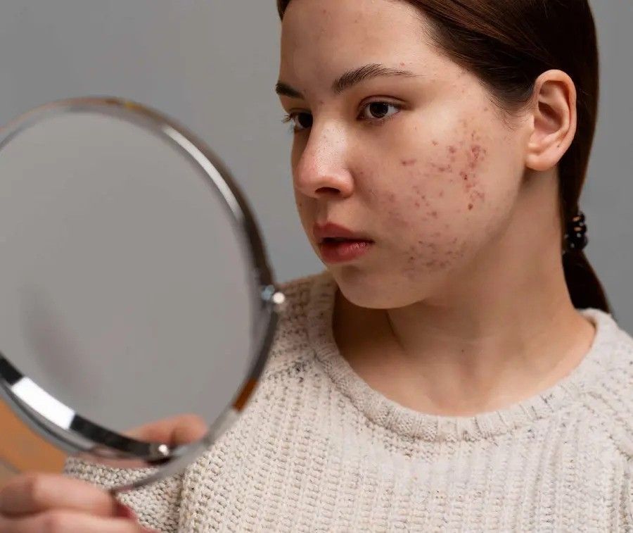 effective-pigmentation-treatment-in-dubai-reveal-clearer-skin-big-0