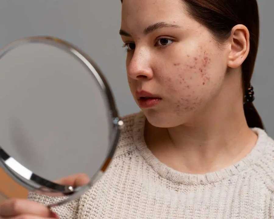 effective-pigmentation-treatment-in-dubai-reveal-clearer-skin