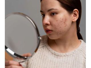 effective-pigmentation-treatment-in-dubai-reveal-clearer-skin-small-0