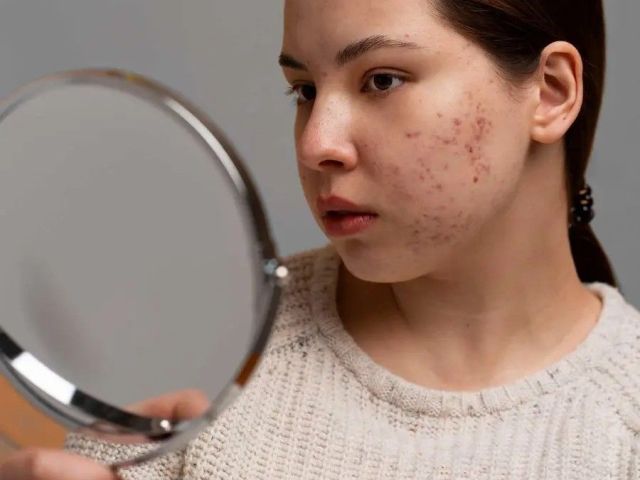 effective-pigmentation-treatment-in-dubai-reveal-clearer-skin
