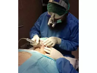 hair-transplant-clinic-near-me-small-0