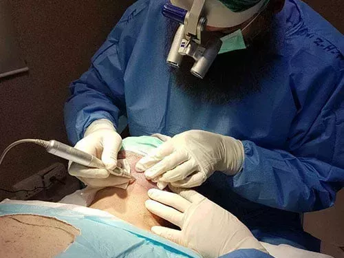 hair-transplant-clinic-near-me