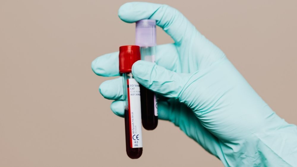 wellness-blood-test-dubai-big-0