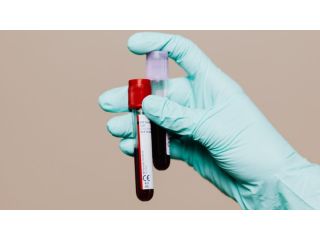 wellness-blood-test-dubai-small-0