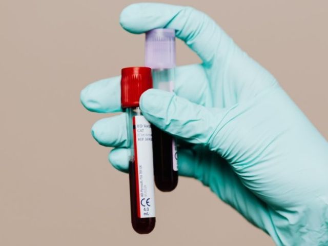 wellness-blood-test-dubai