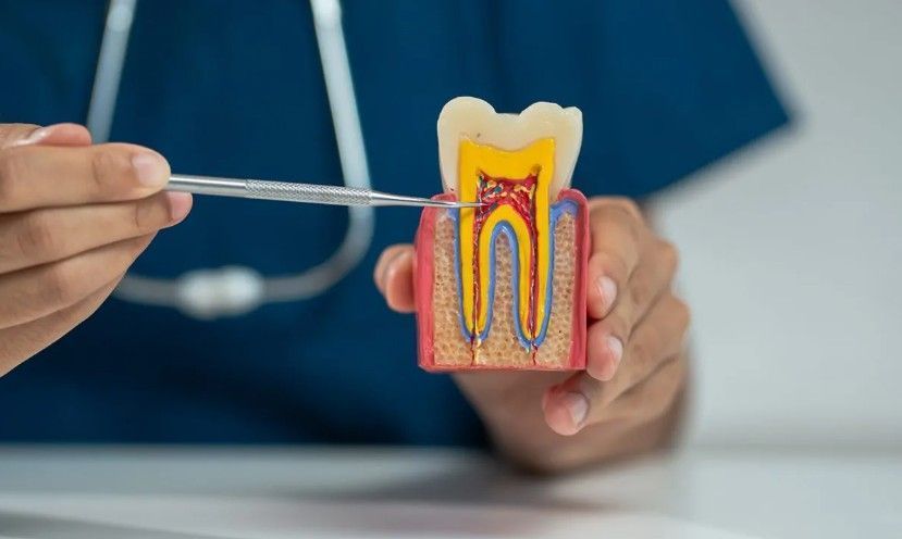 advanced-root-canal-treatment-in-al-ain-big-0
