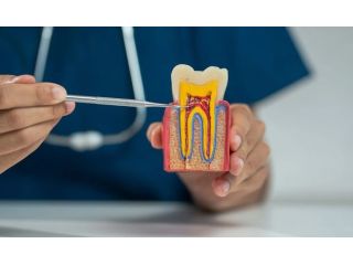 advanced-root-canal-treatment-in-al-ain-small-0