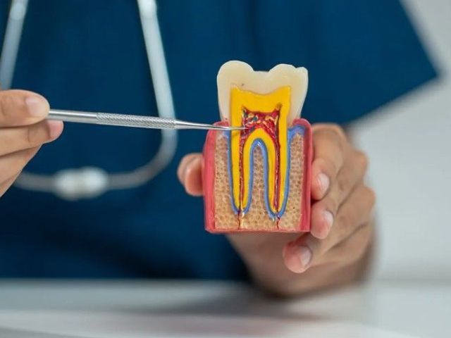 advanced-root-canal-treatment-in-al-ain