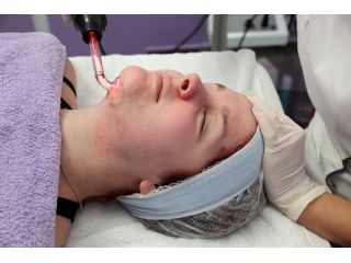 best-clinics-for-repairing-sun-damaged-skin-in-dubai-small-0