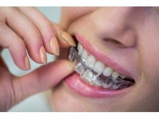 invisible-smile-transformation-with-clear-aligners-in-dubai-small-0