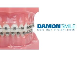 advanced-damon-braces-treatment-services-in-jumeirah-dubai-small-0