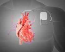 expert-care-at-pacemaker-clinic-abu-dhabi