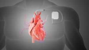 expert-care-at-pacemaker-clinic-abu-dhabi-big-0