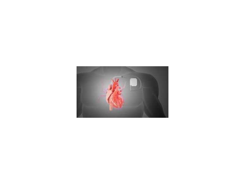 expert-care-at-pacemaker-clinic-abu-dhabi-small-0