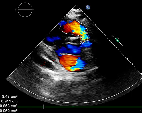 colour-doppler-ultrasound-sharjah