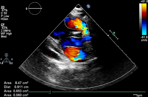 colour-doppler-ultrasound-sharjah-big-0