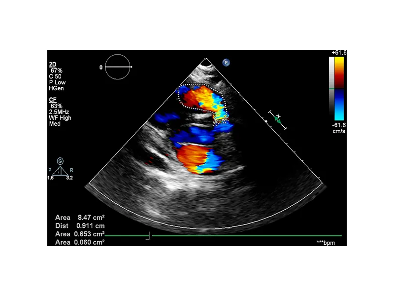 colour-doppler-ultrasound-sharjah-small-0