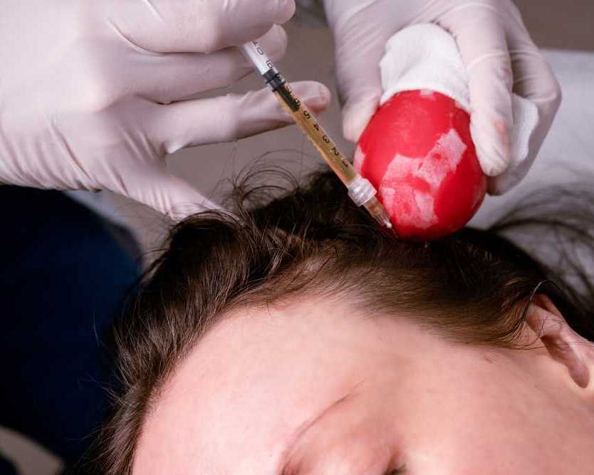 top-benefits-of-getting-prp-treatment-in-dubai