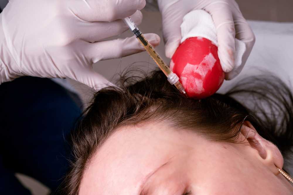 top-benefits-of-getting-prp-treatment-in-dubai-big-0