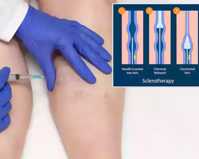 best-vascular-surgeon-in-abu-dhabi-for-advanced-vein-care