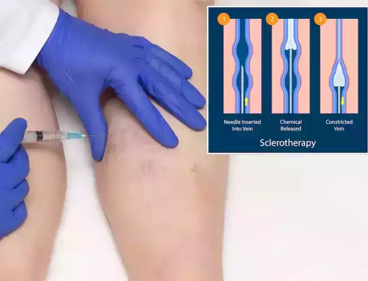 best-vascular-surgeon-in-abu-dhabi-for-advanced-vein-care-big-0