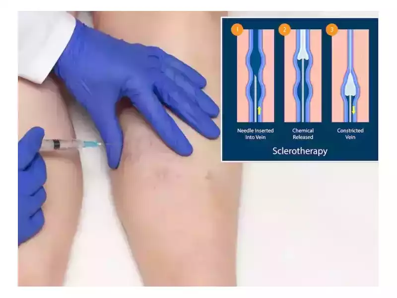 best-vascular-surgeon-in-abu-dhabi-for-advanced-vein-care-small-0