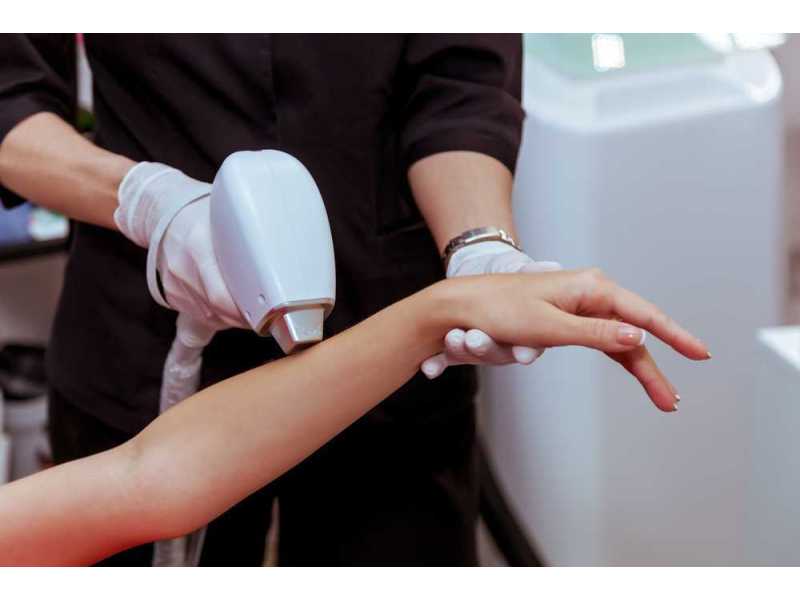 exploring-laser-hair-removal-cost-in-dubai-and-its-long-term-benefits-small-0