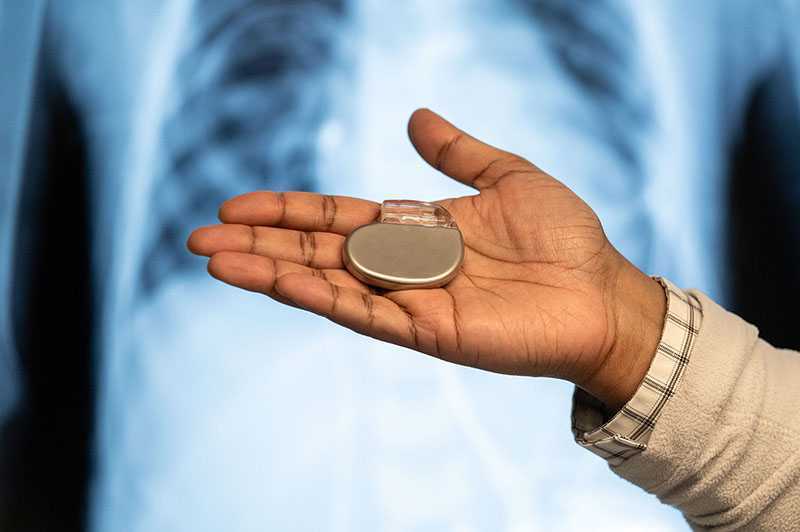 pacemaker-treatment-by-dr-moutaz-el-kadri-big-0