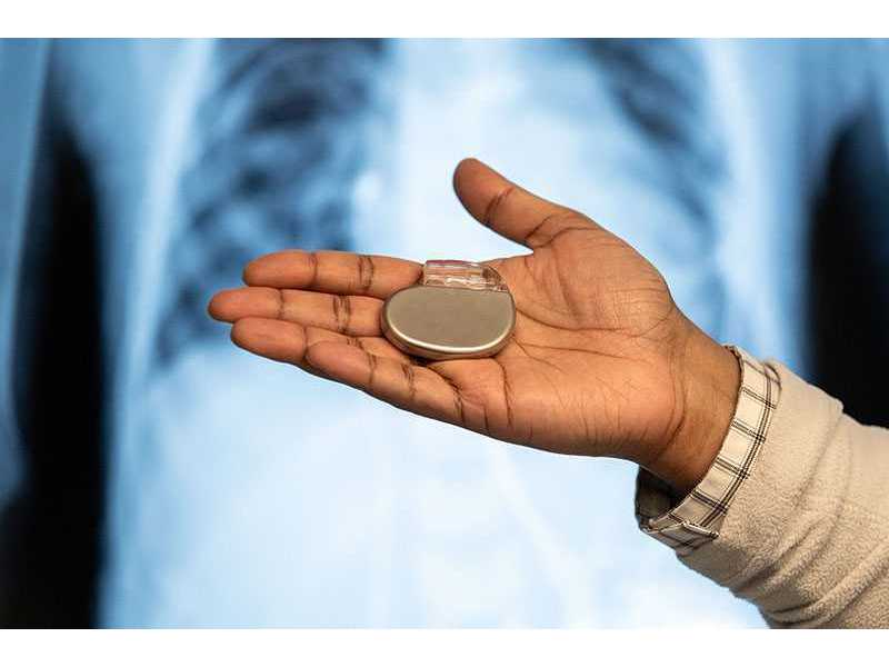 pacemaker-treatment-by-dr-moutaz-el-kadri-small-0
