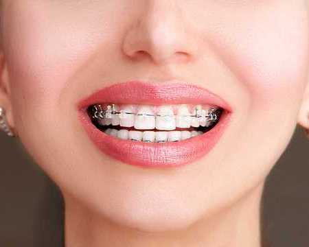 tmj-disorder-treatment-by-top-orthodontist-specialist-in-dubai