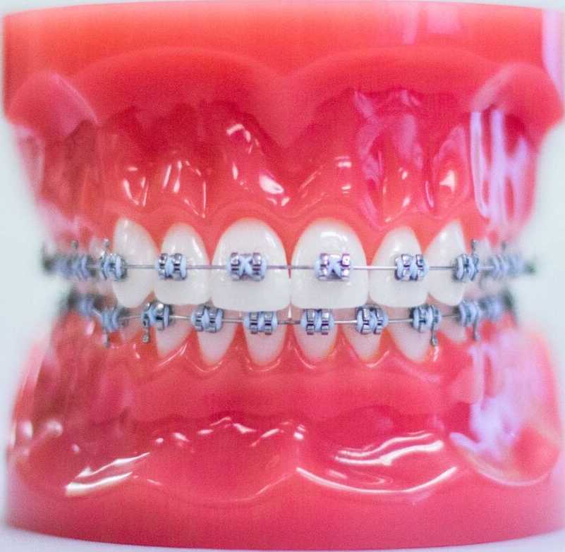 tmj-disorder-treatment-by-top-orthodontist-specialist-in-dubai-big-1
