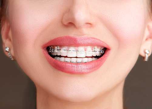 tmj-disorder-treatment-by-top-orthodontist-specialist-in-dubai-big-0
