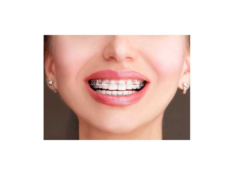 tmj-disorder-treatment-by-top-orthodontist-specialist-in-dubai-small-0