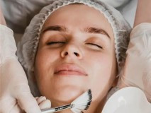 best-skin-peeling-acne-peel-treatments-for-skin-rejuvenation-big-0