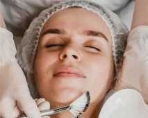 best-skin-peeling-acne-peel-treatments-for-skin-rejuvenation