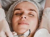best-skin-peeling-acne-peel-treatments-for-skin-rejuvenation