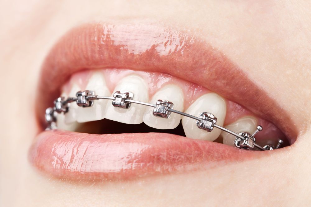 union-road-dental-big-2