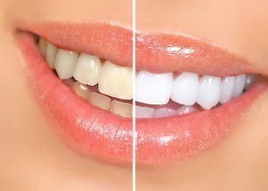 union-road-dental-big-1