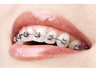 union-road-dental-small-2