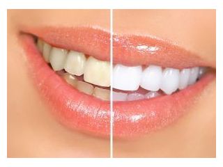 union-road-dental-small-1