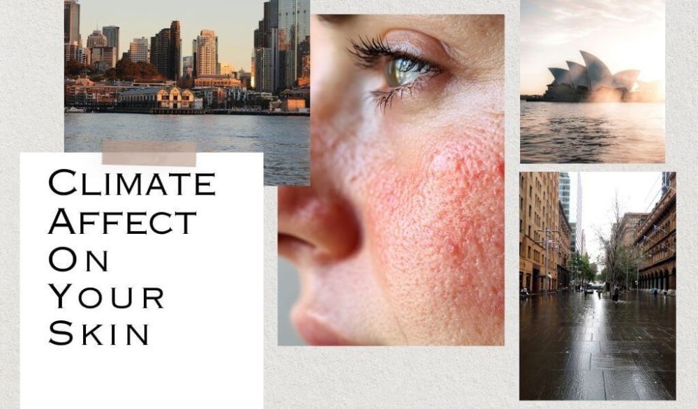 sydney-climate-skin-health-impact-protection-care-tips-big-0