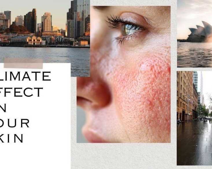 sydney-climate-skin-health-impact-protection-care-tips