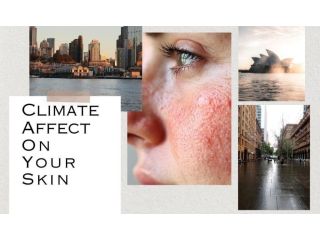 sydney-climate-skin-health-impact-protection-care-tips-small-0
