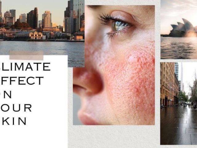 sydney-climate-skin-health-impact-protection-care-tips