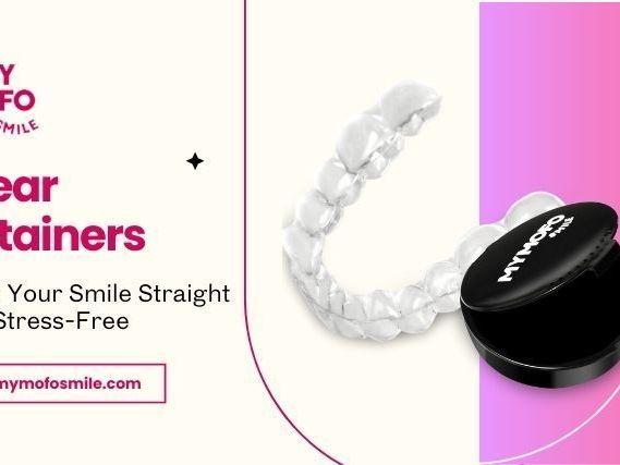 custom-retainer-for-teeth-straightening-shop-online