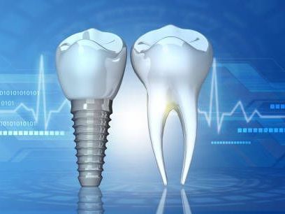 advanced-orthodontics-in-liverpool-for-precision-alignment