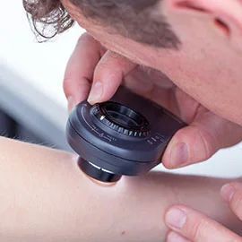 skin-cancer-check-doctor-clinic-big-1