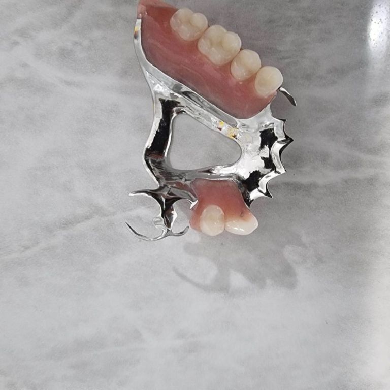 trusted-dental-crown-brisbane-services-book-your-appointment-big-2