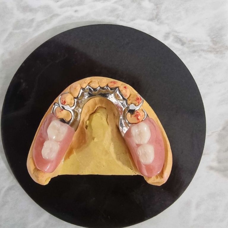 trusted-dental-crown-brisbane-services-book-your-appointment-big-3