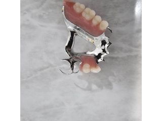 trusted-dental-crown-brisbane-services-book-your-appointment-small-2